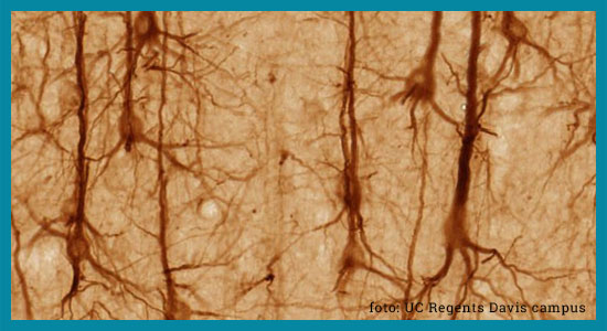 Zdjęcie neuronów w powiększeniu